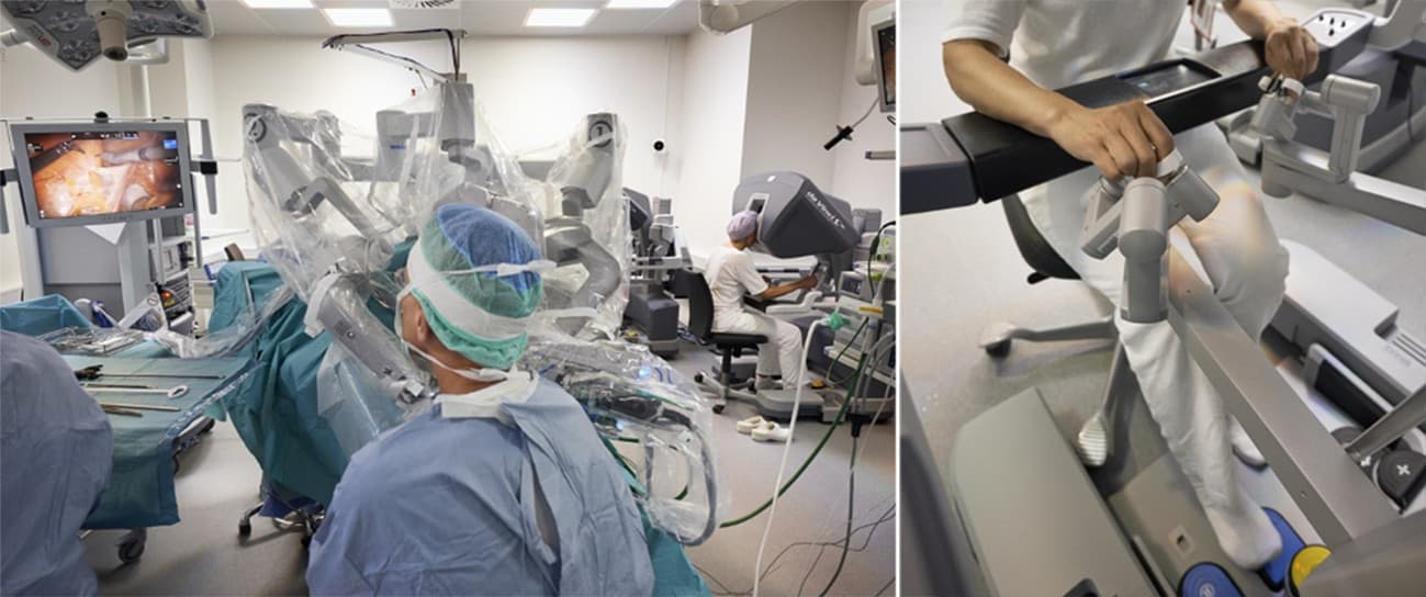 Operationsstue på Odense Universitetshospitals Robotkirurgisk Center. A. Til højre i billede ses konsolkirurgen, der har tre instrumenter tilgængeligt intraabdominalt; to ad gangen kan anvendes aktivt, mens det tredje instrument kan holde i strukturer. B. Fod­pedaler og såkaldte håndcontrollere, som konsolkirurgen styrer kamera og instrumenter med. Patienten er vippet 30 grader Trendelenburg, og robottens tre arme er docket til trokarer i bugvæggen. 